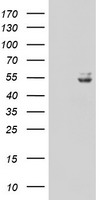 HEK293T cells were transfected with the pCMV6-ENTRY control (Left lane) or pCMV6-ENTRY UQCRC1 (Right lane) cDNA for 48 hrs and lysed