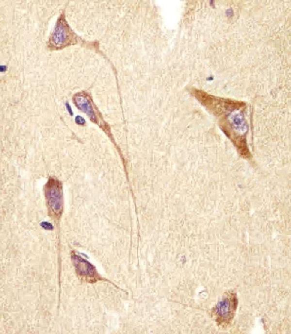 m06975 anti gng2 antibody n term ihc p testing 2