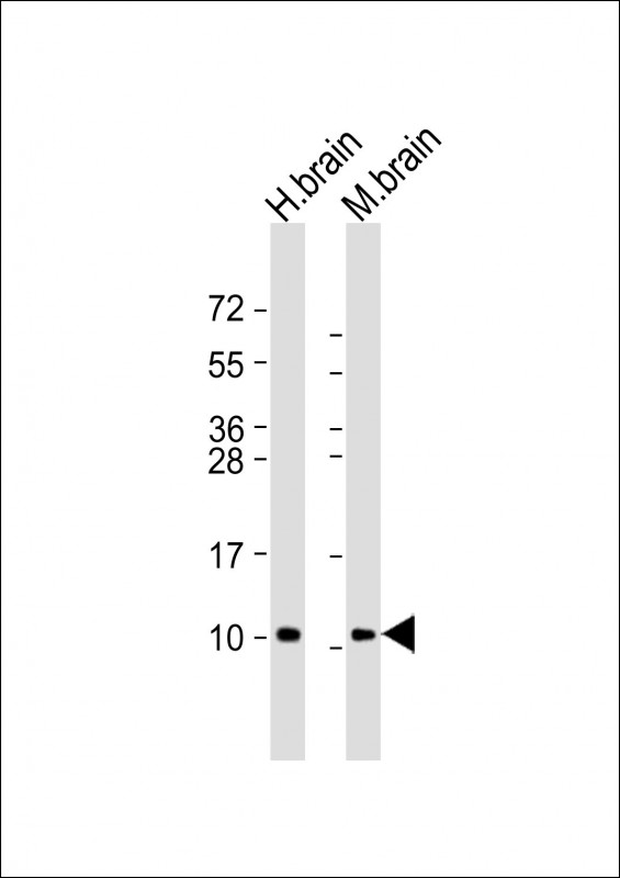 m06975 anti gng2 antibody n term wb testing 1