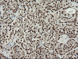 m06981 anti malignant t cell amplified sequence 1 mcts1 mouse monoclonal antibody clone id oti2f9 ihc testing 2