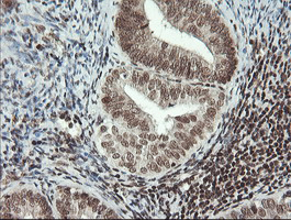m06981 anti malignant t cell amplified sequence 1 mcts1 mouse monoclonal antibody clone id oti2f9 ihc testing 3