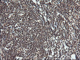 m06981 anti malignant t cell amplified sequence 1 mcts1 mouse monoclonal antibody clone id oti2f9 ihc testing 5