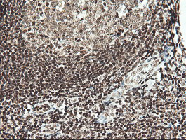 m06981 anti malignant t cell amplified sequence 1 mcts1 mouse monoclonal antibody clone id oti2f9 ihc testing 6