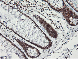m06981 anti malignant t cell amplified sequence 1 mcts1 mouse monoclonal antibody clone id oti2f9 ihc testing 7
