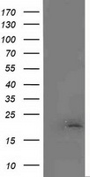 m06981 anti malignant t cell amplified sequence 1 mcts1 mouse monoclonal antibody clone id oti2f9 wb testing 1