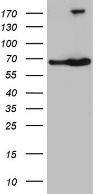 HEK293T cells were transfected with the pCMV6-ENTRY control (Left lane) or pCMV6-ENTRY TAF1B (Right lane) cDNA for 48 hrs and lysed