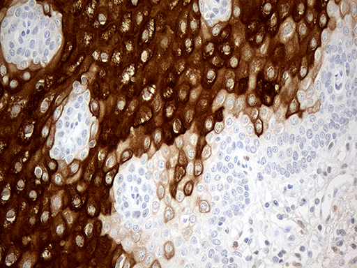 m06991 anti cornulin crnn mouse monoclonal antibody clone id oti4b8 ihc testing 2