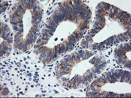 m06993 anti trap alpha ssr1 mouse monoclonal antibody clone id oti4c7 ihc testing 10