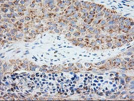 m06993 anti trap alpha ssr1 mouse monoclonal antibody clone id oti4c7 ihc testing 11