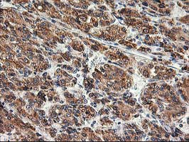 m06993 anti trap alpha ssr1 mouse monoclonal antibody clone id oti4c7 ihc testing 12