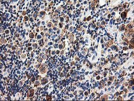 m06993 anti trap alpha ssr1 mouse monoclonal antibody clone id oti4c7 ihc testing 4