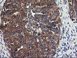m06993 anti trap alpha ssr1 mouse monoclonal antibody clone id oti4c7 ihc testing 5