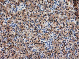 m06993 anti trap alpha ssr1 mouse monoclonal antibody clone id oti4c7 ihc testing 6