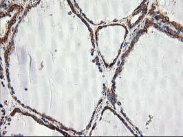 m06993 anti trap alpha ssr1 mouse monoclonal antibody clone id oti4c7 ihc testing 7