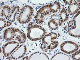 m06993 anti trap alpha ssr1 mouse monoclonal antibody clone id oti4c7 ihc testing 8