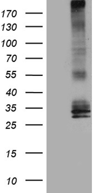 m06998 anti aquaporin 8 aqp8 mouse monoclonal antibody clone id oti6c9 wb testing 1