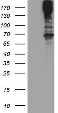 HEK293T cells were transfected with the pCMV6-ENTRY control (Left lane) or pCMV6-ENTRY MAST2 (Right lane) cDNA for 48 hrs and lysed
