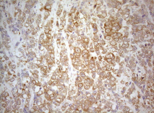 m07004 1 anti ptk9 twf1 mouse monoclonal antibody clone id oti5c12 ihc testing 10