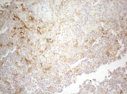 m07004 1 anti ptk9 twf1 mouse monoclonal antibody clone id oti5c12 ihc testing 11