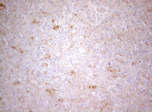 m07004 1 anti ptk9 twf1 mouse monoclonal antibody clone id oti5c12 ihc testing 12