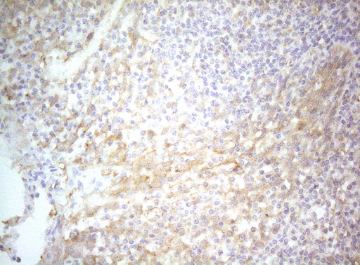 m07004 1 anti ptk9 twf1 mouse monoclonal antibody clone id oti5c12 ihc testing 13
