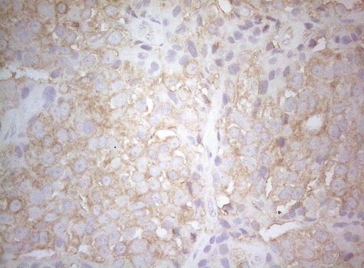 m07004 1 anti ptk9 twf1 mouse monoclonal antibody clone id oti5c12 ihc testing 14