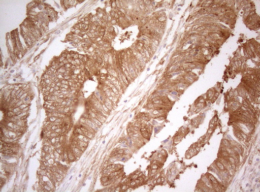 m07004 1 anti ptk9 twf1 mouse monoclonal antibody clone id oti5c12 ihc testing 15