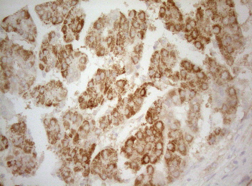 m07004 1 anti ptk9 twf1 mouse monoclonal antibody clone id oti5c12 ihc testing 16