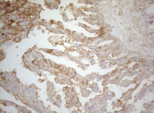 m07004 1 anti ptk9 twf1 mouse monoclonal antibody clone id oti5c12 ihc testing 3
