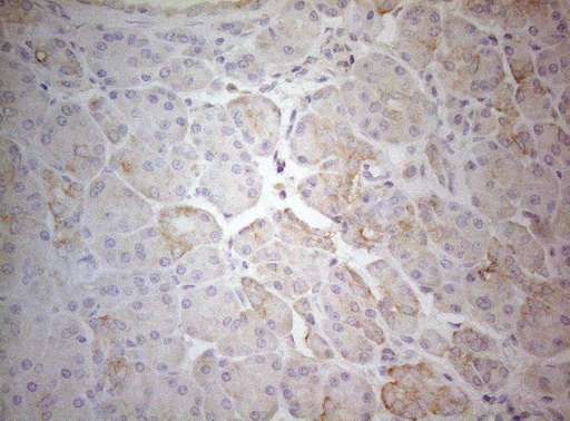 m07004 1 anti ptk9 twf1 mouse monoclonal antibody clone id oti5c12 ihc testing 4