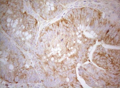 m07004 1 anti ptk9 twf1 mouse monoclonal antibody clone id oti5c12 ihc testing 5