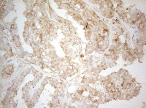 m07004 1 anti ptk9 twf1 mouse monoclonal antibody clone id oti5c12 ihc testing 6