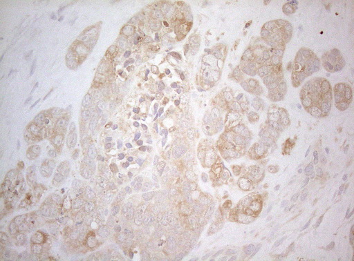 m07004 1 anti ptk9 twf1 mouse monoclonal antibody clone id oti5c12 ihc testing 7
