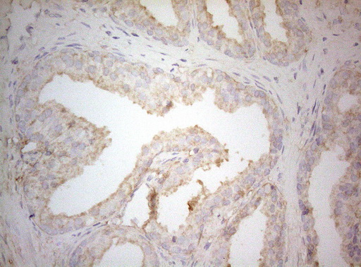 m07004 1 anti ptk9 twf1 mouse monoclonal antibody clone id oti5c12 ihc testing 8
