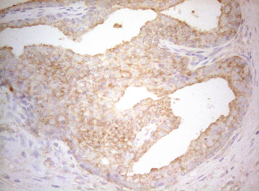 m07004 1 anti ptk9 twf1 mouse monoclonal antibody clone id oti5c12 ihc testing 9