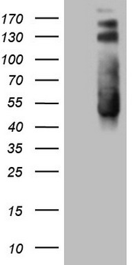 m07004 1 anti ptk9 twf1 mouse monoclonal antibody clone id oti5c12 wb testing 1