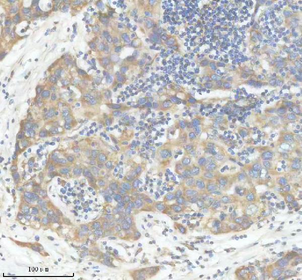 IHC analysis of MYO1B using anti-MYO1B antibody (M07011)