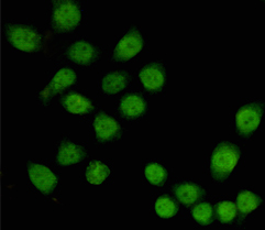 m07014 tbl1x primary antiboties icc testing 2