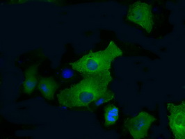 m07028 anti pfkfb4 mouse monoclonal antibody clone id oti1c8 if testing 2