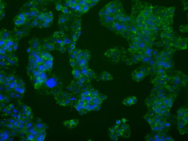 m07028 anti pfkfb4 mouse monoclonal antibody clone id oti1c8 if testing 3