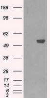 m07028 anti pfkfb4 mouse monoclonal antibody clone id oti1c8 wb testing 1