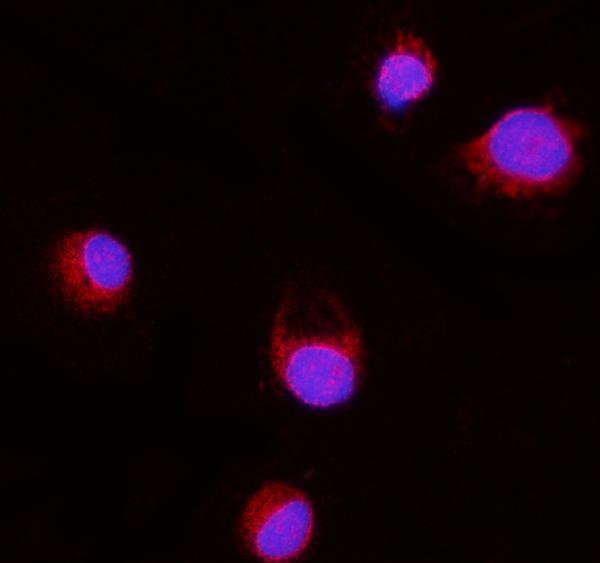 m07042 1 erlin2 primary antibodies if testing 6