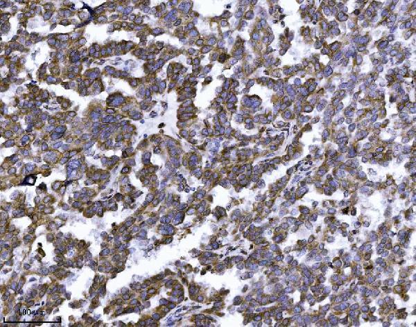 m07042 1 erlin2 primary antibodies ihc testing 2