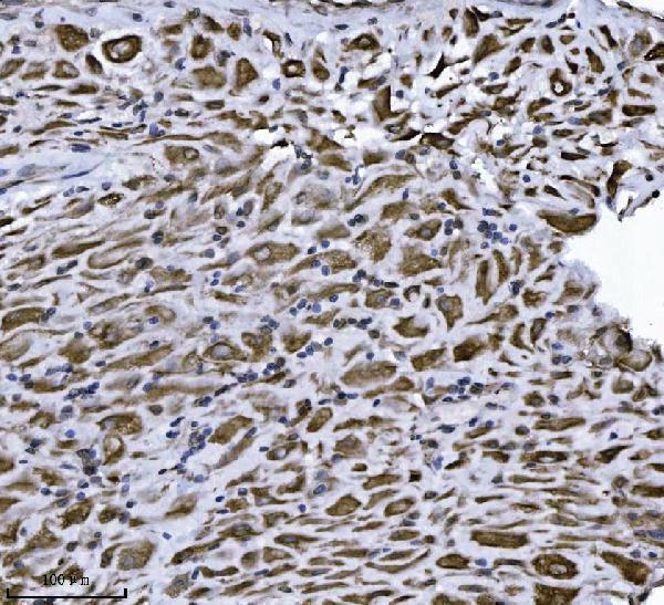 m07042 1 erlin2 primary antibodies ihc testing 3