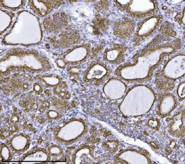 m07042 1 erlin2 primary antibodies ihc testing 5