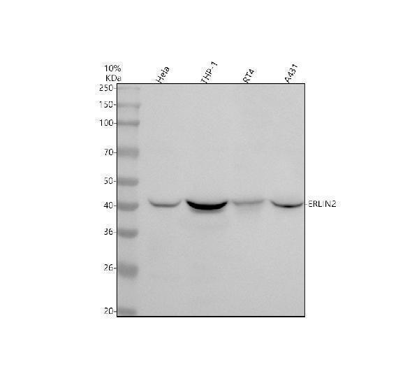 m07042 erlin2 primary antibodies wb testing 1