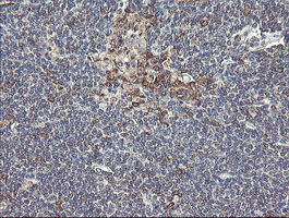 m07059 anti ubc6e ube2j1 mouse monoclonal antibody clone id oti3d1 ihc testing 11