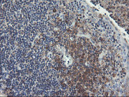 m07059 anti ubc6e ube2j1 mouse monoclonal antibody clone id oti3d1 ihc testing 12