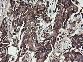 m07059 anti ubc6e ube2j1 mouse monoclonal antibody clone id oti3d1 ihc testing 13