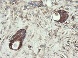 m07059 anti ubc6e ube2j1 mouse monoclonal antibody clone id oti3d1 ihc testing 14